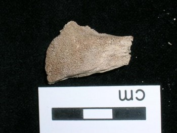 Figure 3: Scurvy- porotic hyperostosis of the frontal bone. St Brides Lower. Museum of London 2019.Accessed 18.10.19.